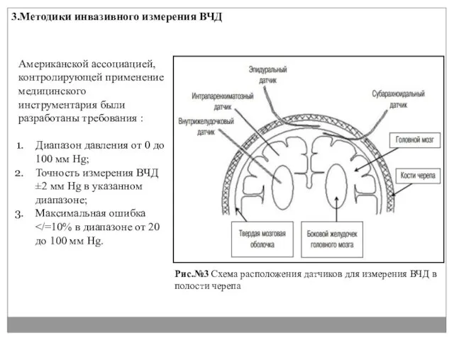 3.Методики инвазивного измерения ВЧД Рис.№3 Схема расположения датчиков для измерения