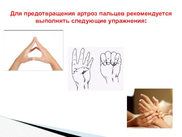 Для предотвращения артроз пальцев рекомендуется выполнять следующие упражнения: