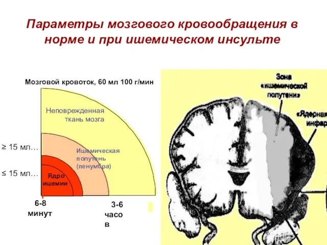 Параметры мозгового кровообращения в норме и при ишемическом инсульте Ядро