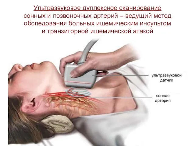 Ультразвуковое дуплексное сканирование сонных и позвоночных артерий – ведущий метод