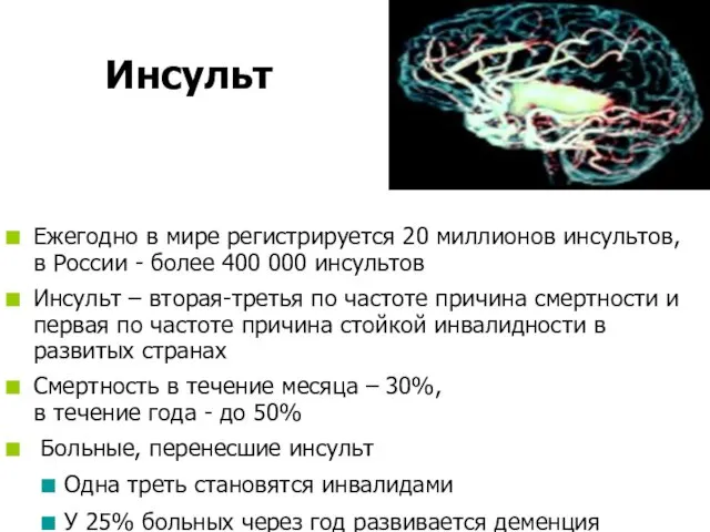 Инсульт Ежегодно в мире регистрируется 20 миллионов инсультов, в России