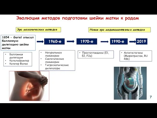 Эволюция методов подготовки шейки матки к родам Эра механических методов