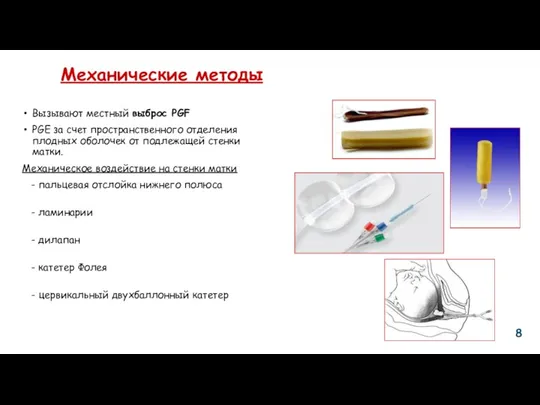 Механические методы Вызывают местный выброс PGF PGE за счет пространственного