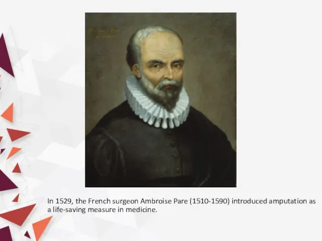 In 1529, the French surgeon Ambroise Pare (1510-1590) introduced amputation as a life-saving measure in medicine.