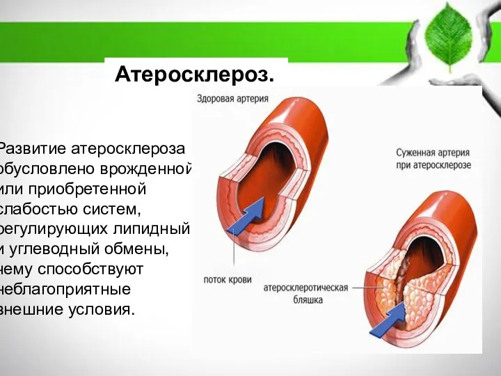 ПЛАН: 1. Массаж: история развития, понятия, основные виды 2. Механизм