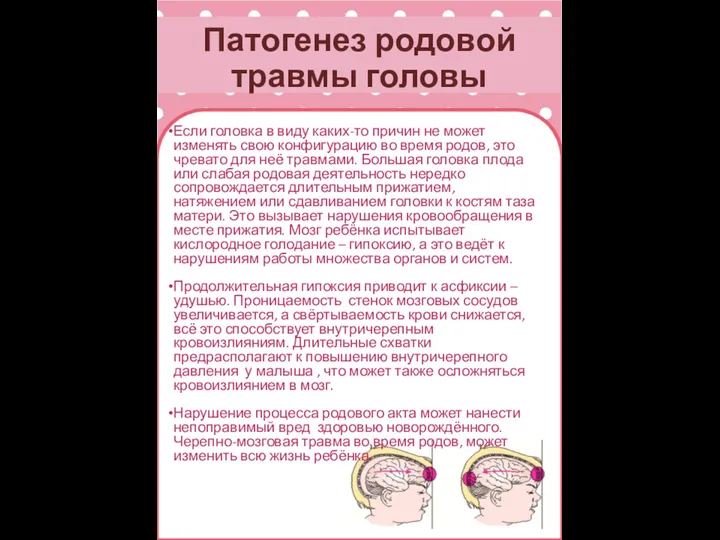 Патогенез родовой травмы головы Если головка в виду каких-то причин