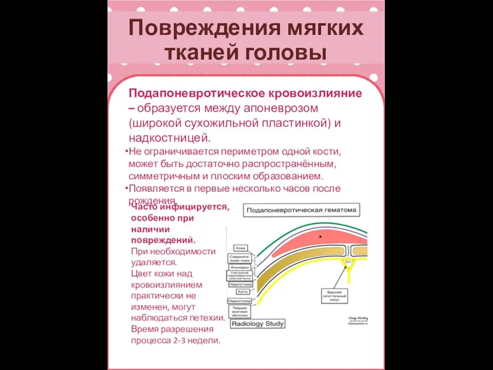 Повреждения мягких тканей головы Подапоневротическое кровоизлияние – образуется между апоневрозом