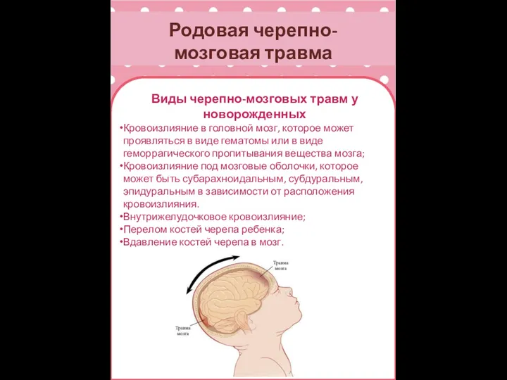 Родовая черепно-мозговая травма Виды черепно-мозговых травм у новорожденных Кровоизлияние в