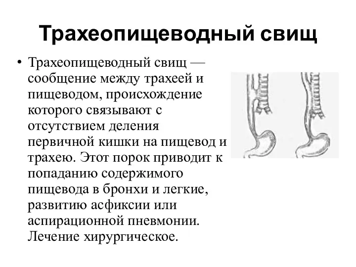 Трахеопищеводный свищ Трахеопищеводный свищ — сообщение между трахеей и пищеводом,