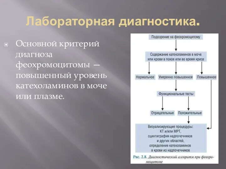 Лабораторная диагностика. Основной критерий диагноза феохромоцитомы — повышенный уровень катехоламинов в моче или плазме.