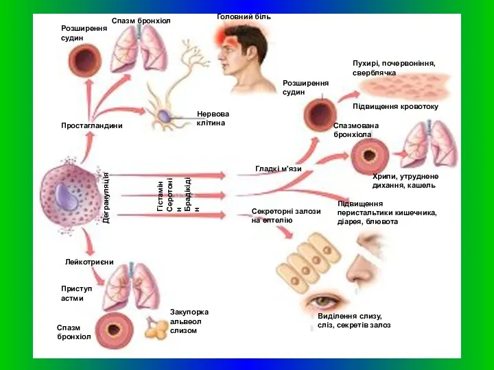 Спазм бронхіол Головний біль Розширення судин Простагландини Нервова клітина Розширення