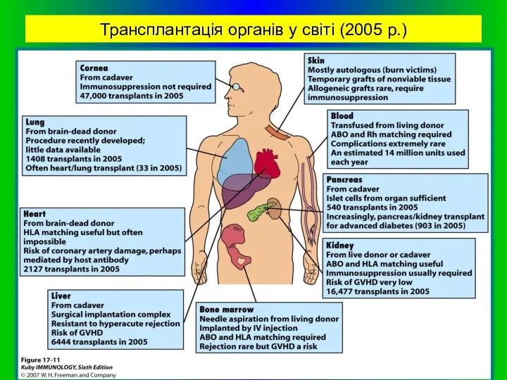 Трансплантація органів у світі (2005 р.)