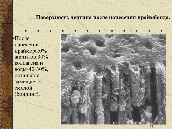 Поверхность дентина после нанесения праймбонда. После нанесения праймера:0% апатитов,30% коллагена и воды-40-30%,остальное замещается смолой (бондинг).