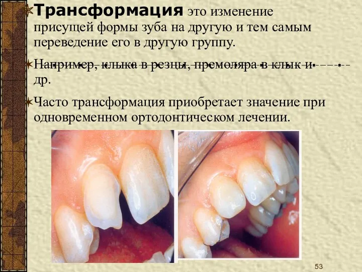 Трансформация это изменение присущей формы зуба на другую и тем