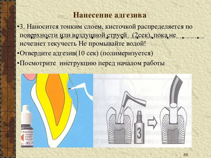 Нанесение адгезива 3. Наносится тонким слоем, кисточкой распределяется по поверхности