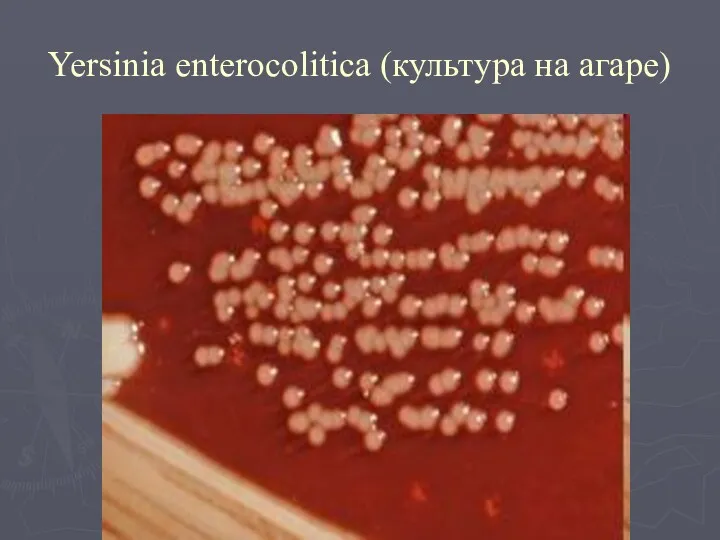 Yersinia enterocolitica (культура на агаре)