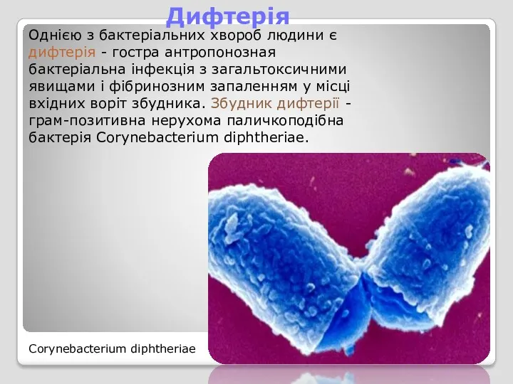 Однією з бактеріальних хвороб людини є дифтерія - гостра антропонозная