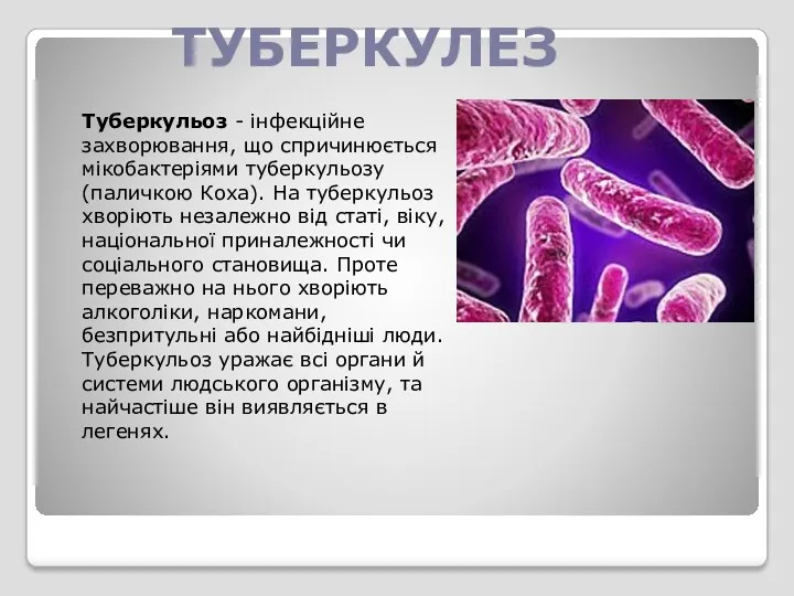 ТУБЕРКУЛЕЗ Туберкульоз - інфекційне захворювання, що спричинюється мікобактеріями туберкульозу (паличкою