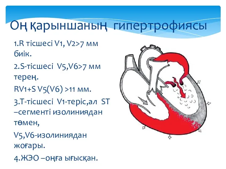 1.R тісшесі V1, V2>7 мм биік. 2.S-тісшесі V5,V6>7 мм терең.