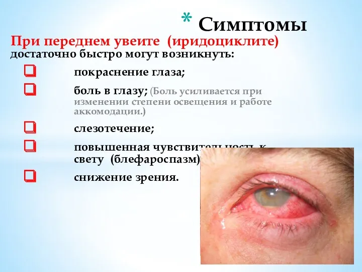 При переднем увеите (иридоциклите) достаточно быстро могут возникнуть: покраснение глаза;