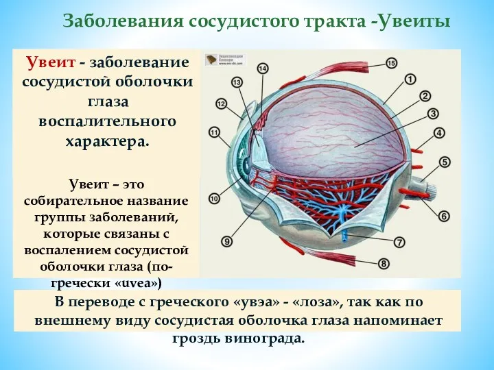 Увеит - заболевание сосудистой оболочки глаза воспалительного характера. Заболевания сосудистого