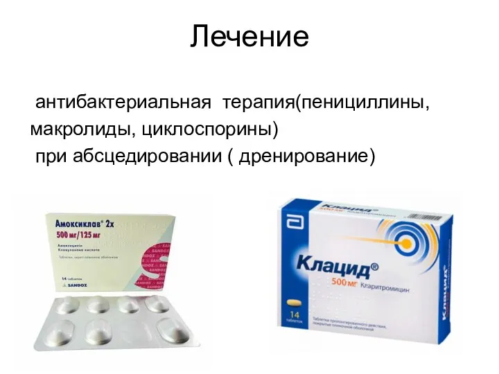 Лечение антибактериальная терапия(пенициллины, макролиды, циклоспорины) при абсцедировании ( дренирование)