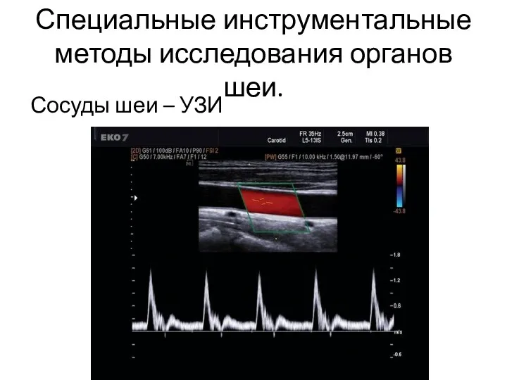 Специальные инструментальные методы исследования органов шеи. Сосуды шеи – УЗИ