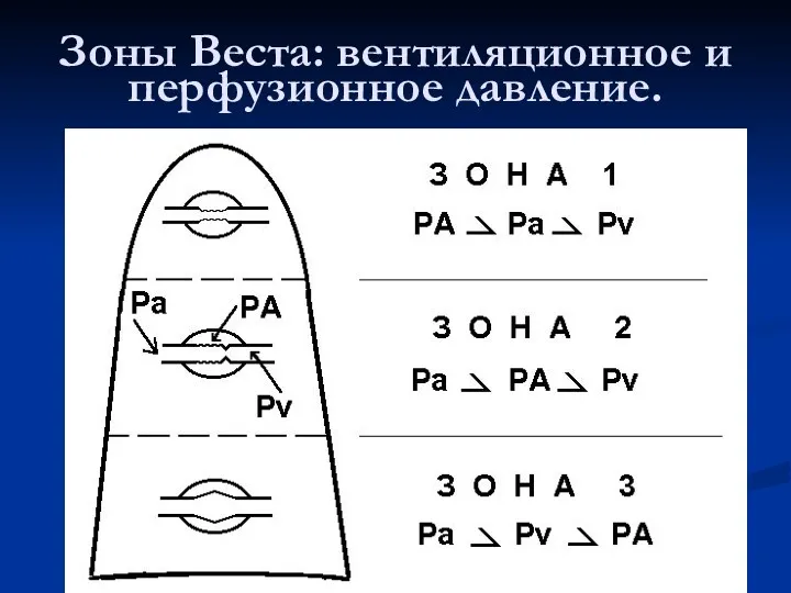 Зоны Веста: вентиляционное и перфузионное давление.