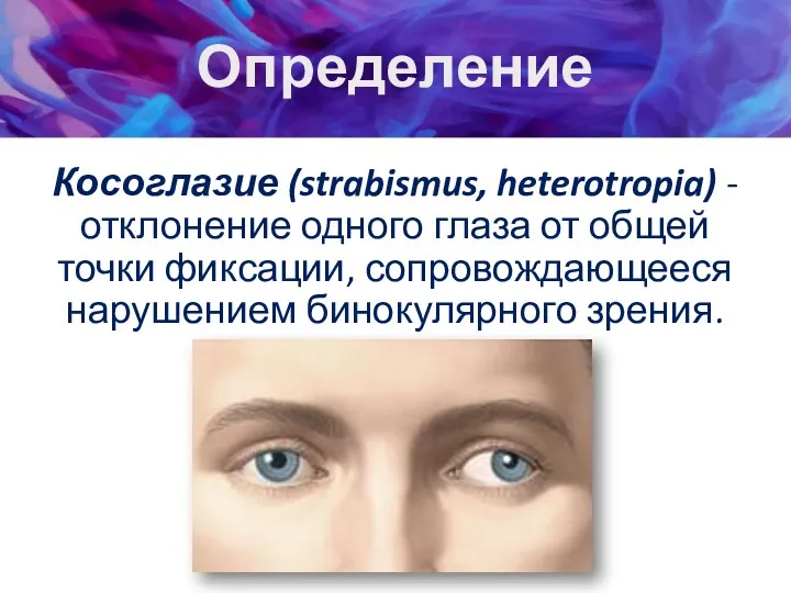 Определение Косоглазие (strabismus, heterotropia) - отклонение одного глаза от общей точки фиксации, сопровождающееся нарушением бинокулярного зрения.