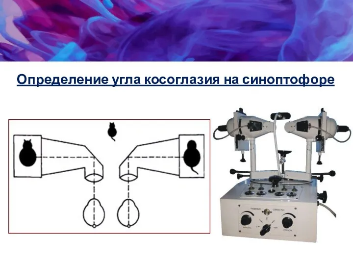 Определение угла косоглазия на синоптофоре