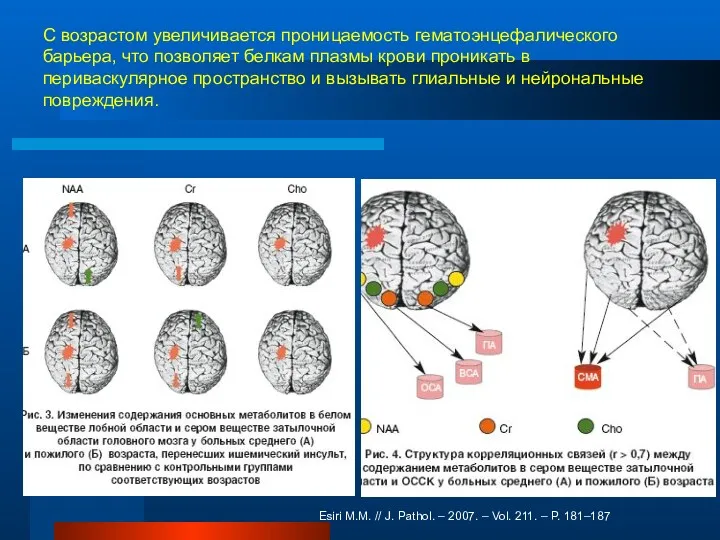 С возрастом увеличивается проницаемость гематоэнцефалического барьера, что позволяет белкам плазмы