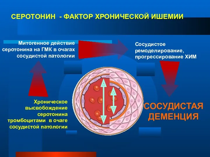 СЕРОТОНИН - ФАКТОР ХРОНИЧЕСКОЙ ИШЕМИИ Сосудистое ремоделирование, прогрессирование ХИМ Хроническое