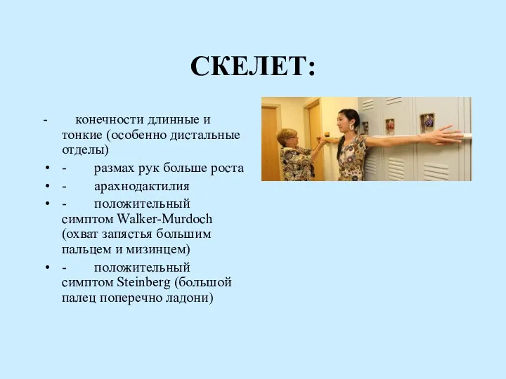 СКЕЛЕТ: - конечности длинные и тонкие (особенно дистальные отделы) -