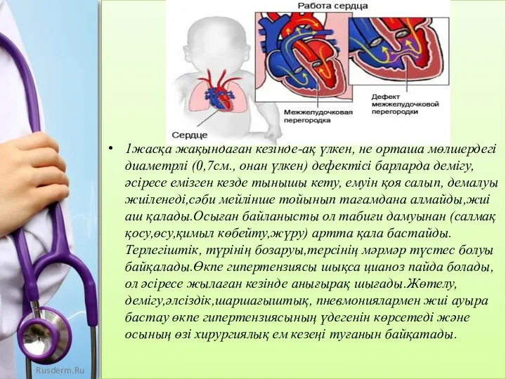 1жасқа жақындаған кезінде-ақ үлкен, не орташа мөлшердегі диаметрлі (0,7см., онан