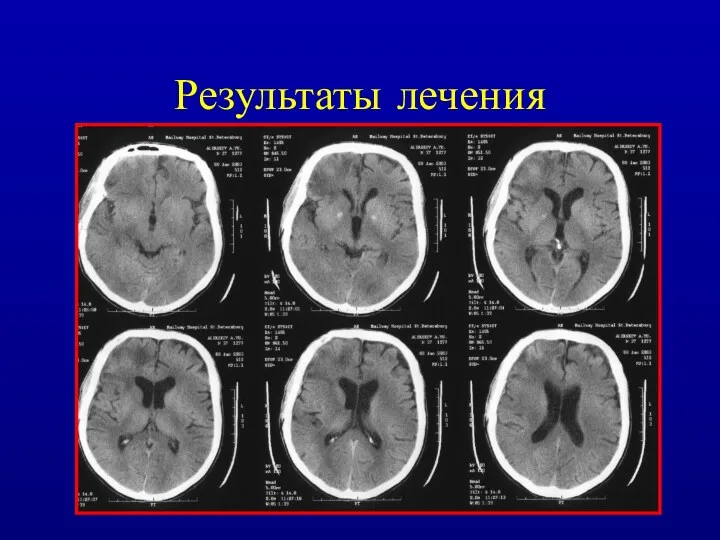 Результаты лечения