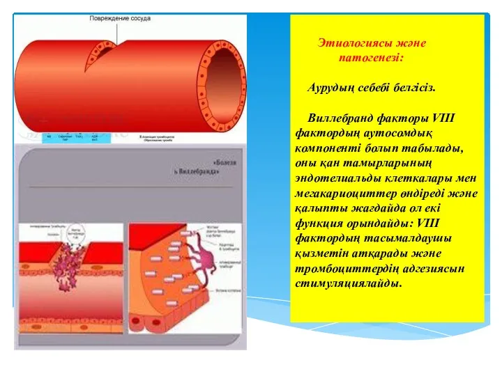 Этиологиясы және патогенезі: Аурудың себебі белгісіз. Виллебранд факторы VIII фактордың