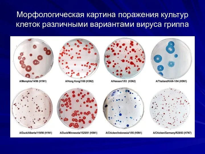 Морфологическая картина поражения культур клеток различными вариантами вируса гриппа