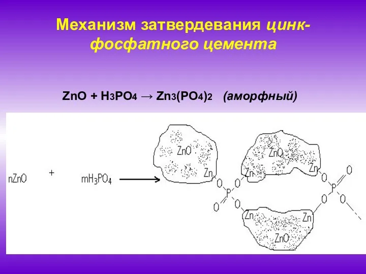 Механизм затвердевания цинк-фосфатного цемента ZnO + H3PO4 → Zn3(PO4)2 (аморфный)