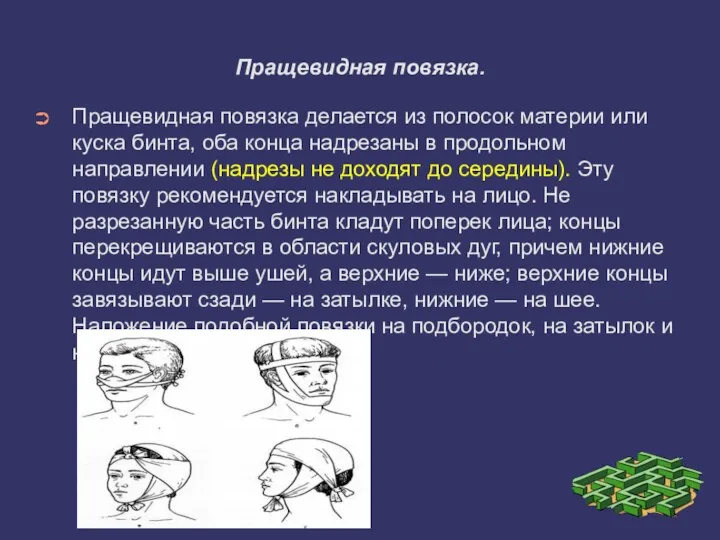 Пращевидная повязка. Пращевидная повязка делается из полосок материи или куска