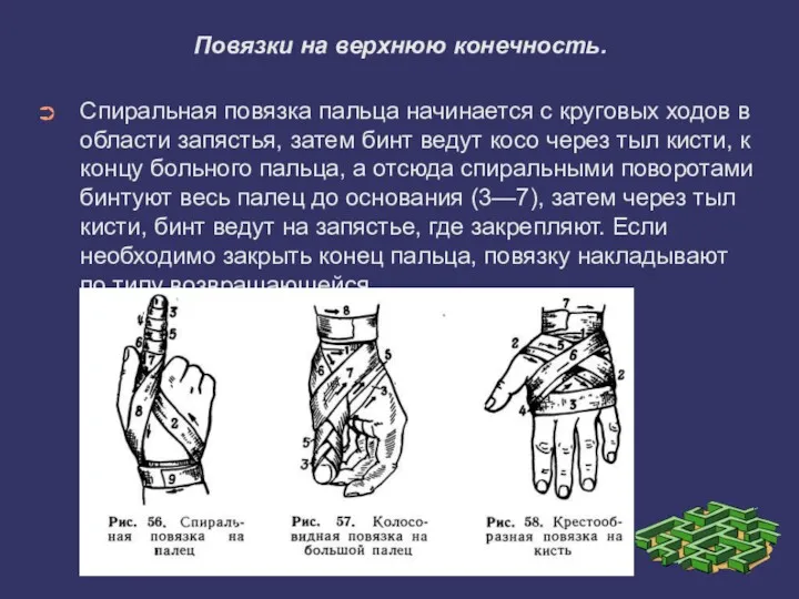 Повязки на верхнюю конечность. Спиральная повязка пальца начинается с круговых