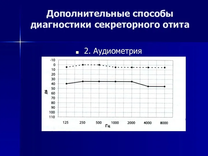 Дополнительные способы диагностики секреторного отита 2. Аудиометрия