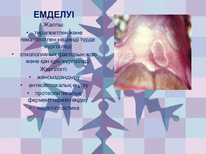 ЕМДЕЛУІ Жалпы: терапевтпен және гематологпен кешенді түрде жүргізіледі этиологиялық факторын