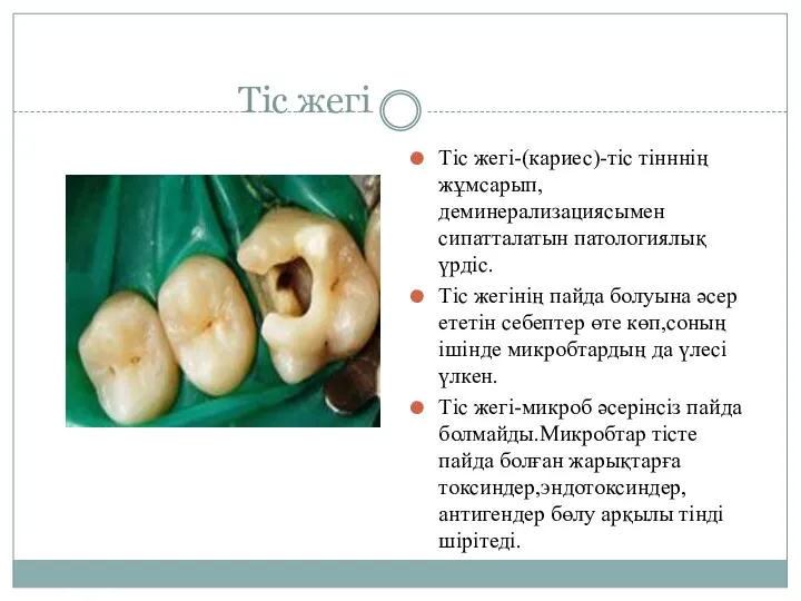 Тіс жегі Тіс жегі-(кариес)-тіс тінннің жұмсарып,деминерализациясымен сипатталатын патологиялық үрдіс. Тіс