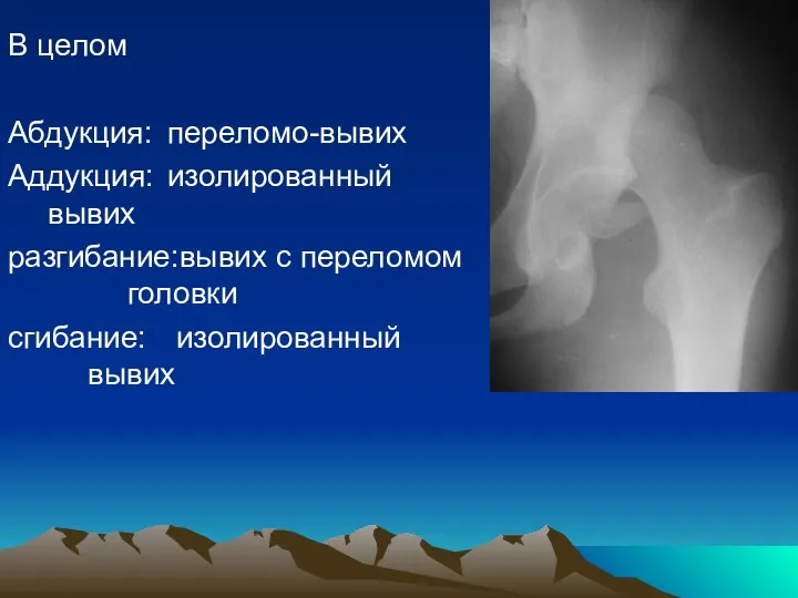 В целом Абдукция: переломо-вывих Аддукция: изолированный вывих разгибание:вывих с переломом головки сгибание: изолированный вывих