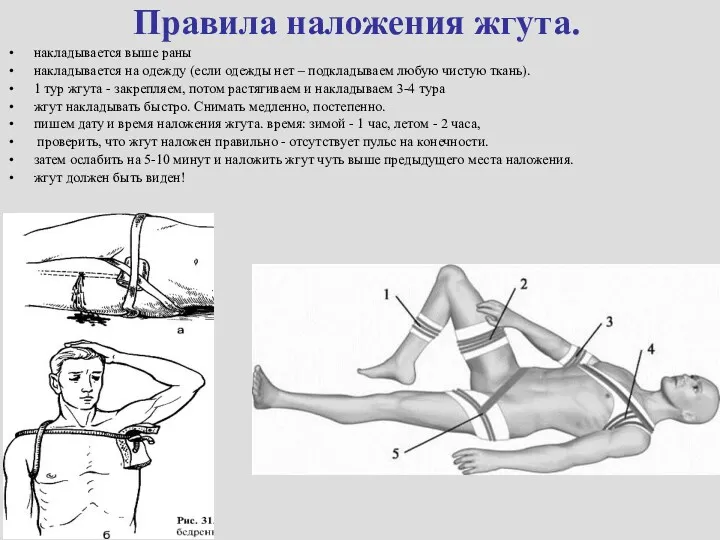 Правила наложения жгута. накладывается выше раны накладывается на одежду (если