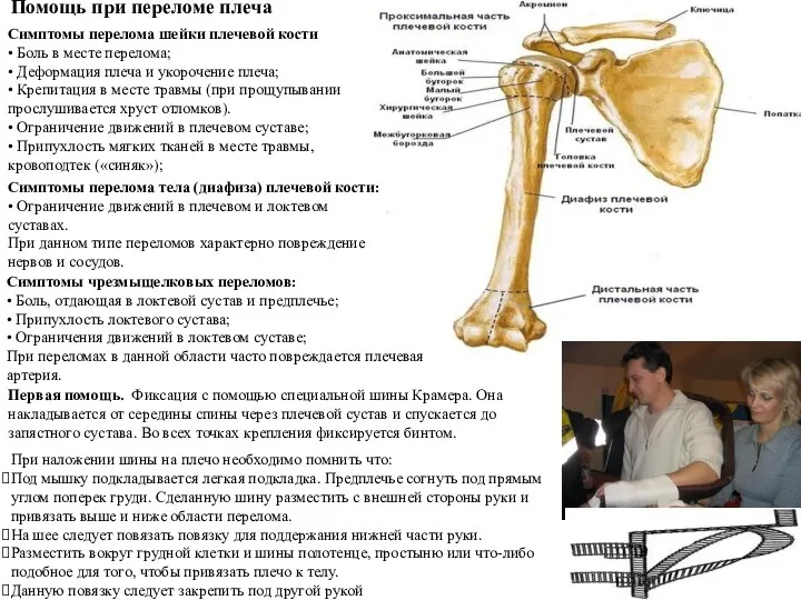 Помощь при переломе плеча Симптомы перелома шейки плечевой кости •