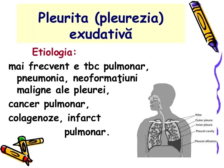 Pleurita (pleurezia) exudativă Etiologia: mai frecvent e tbc pulmonar, pneumonia,