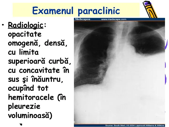 Examenul paraclinic Radiologic: opacitate omogenă, densă, cu limita superioară curbă,