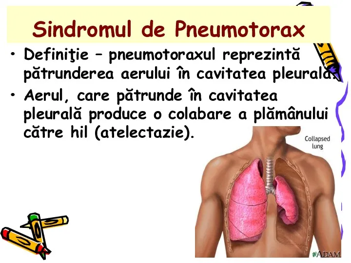 Sindromul de Pneumotorax Definiţie – pneumotoraxul reprezintă pătrunderea aerului în