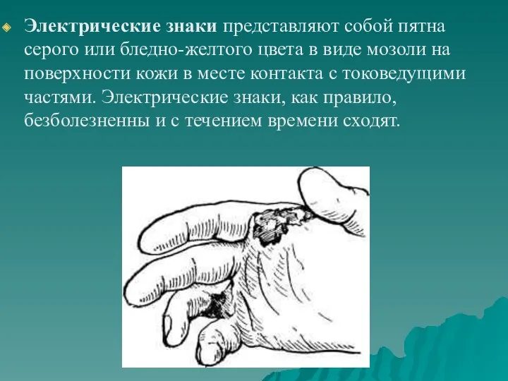 Электрические знаки представляют собой пятна серого или бледно-желтого цвета в